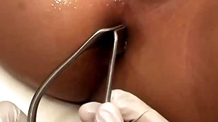 Asian patient penetrated in anal hole by stud in missionary